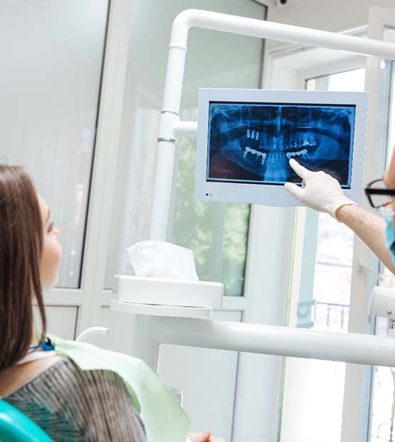 Flower Mound implant dentist explaining dental implants to patient with X-ray
