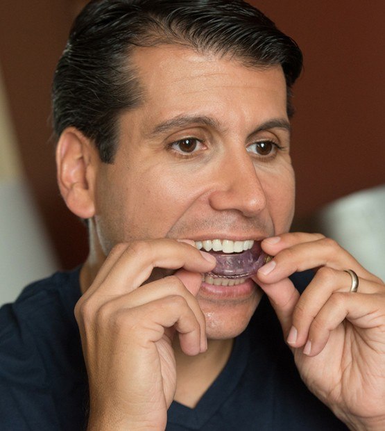 Man placing an oral appliance