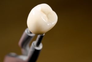 All-ceramic dental crown in lab